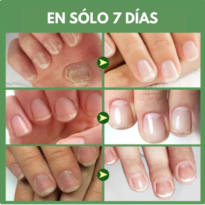 BASE ENDURECEDORA UÑAS DE TITANIO X 3